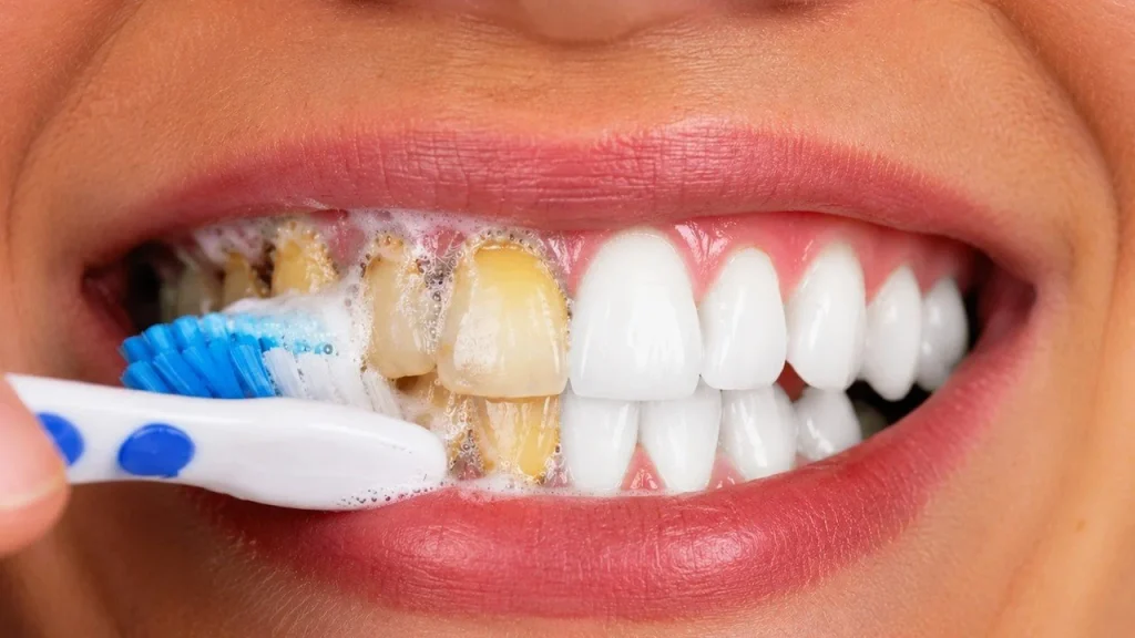 Whitening Teeth Paste for brightening smiles and enhancing dental beauty.